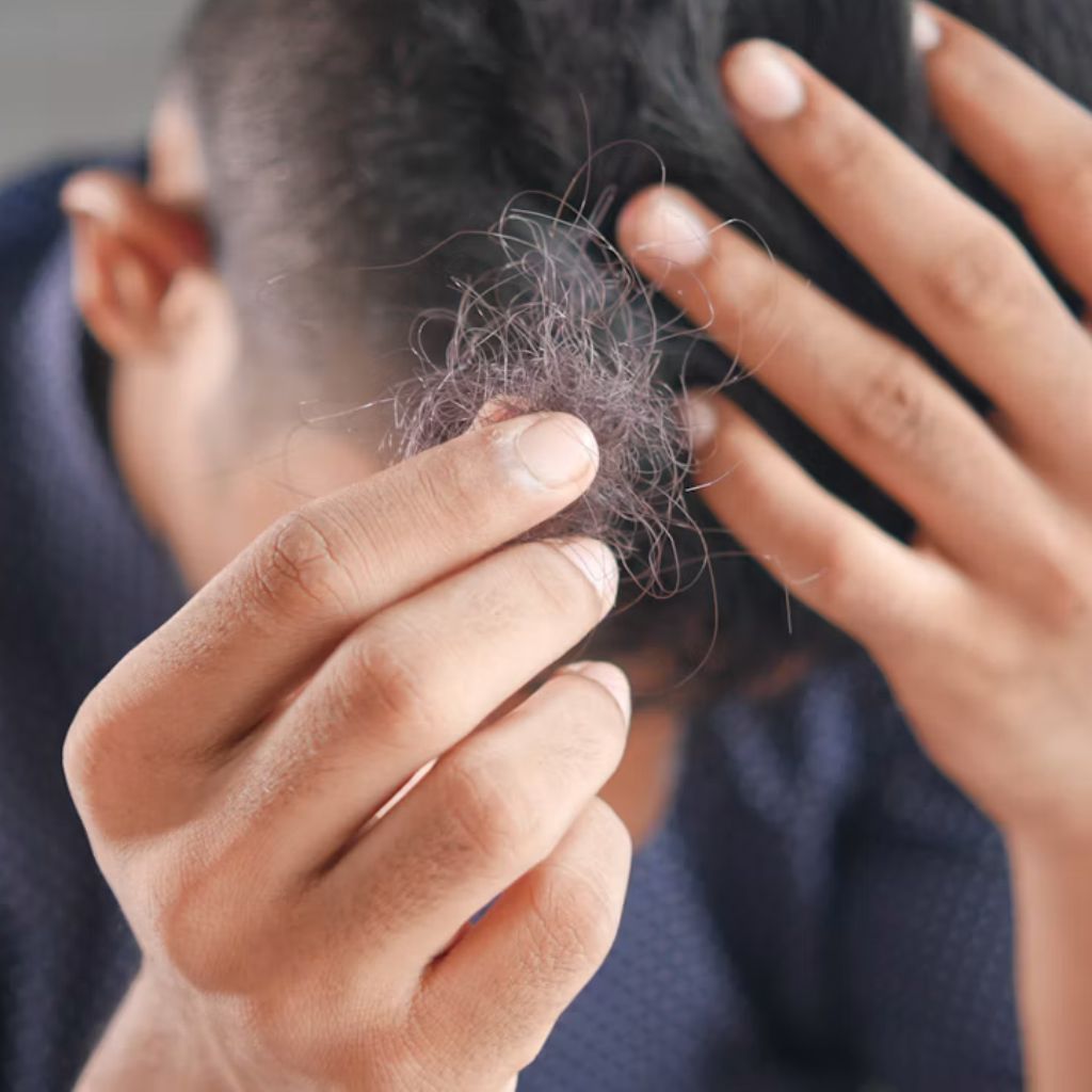 tricopigmentazione-alopecia-areata-capelli-naturale